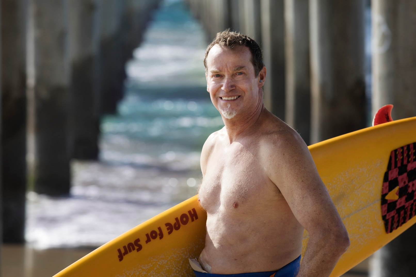 Senhor com um estoma em tronco nu na praia a segurar uma prancha de surf