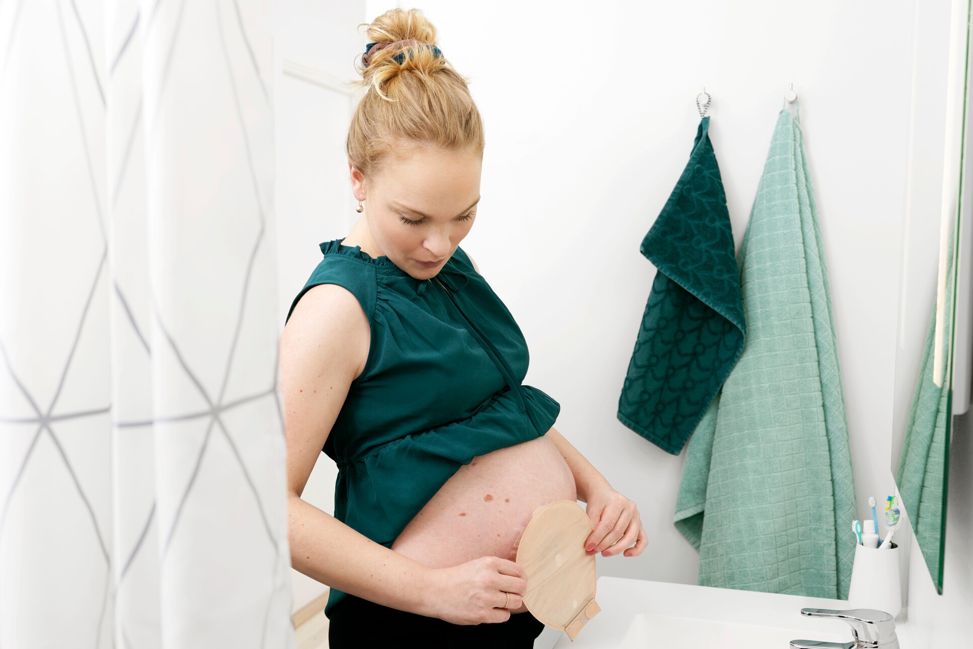 mulher gravida com ostomia 
